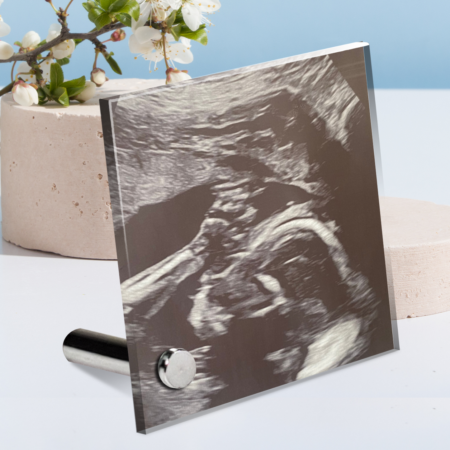 Personalized Baby Sonogram Lumenglass Plaque: Cherish Every Moment