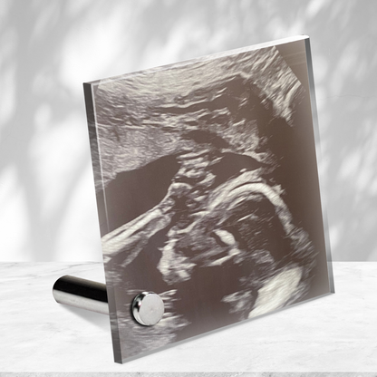 Personalized Baby Sonogram Lumenglass Plaque: Cherish Every Moment