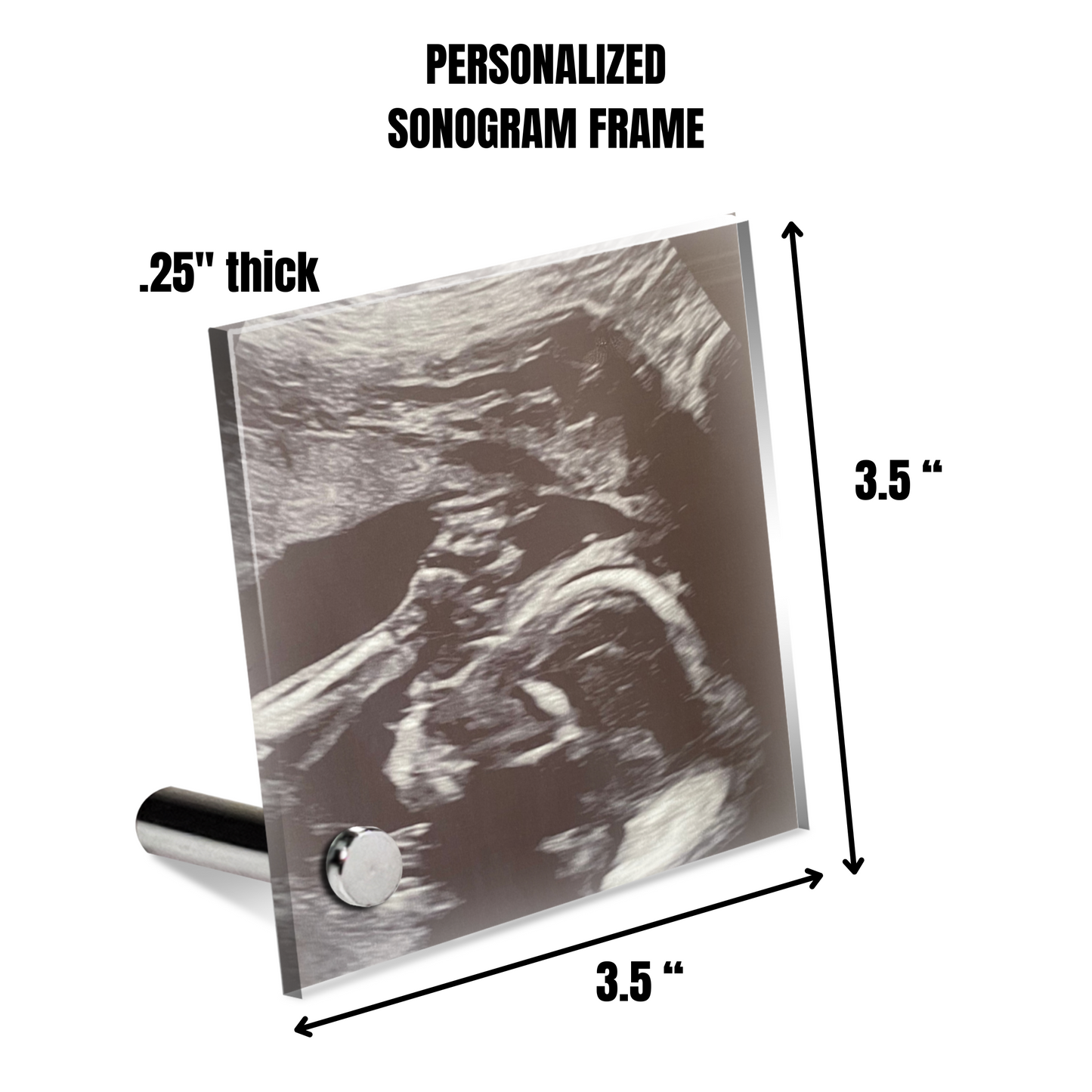 Personalized Baby Sonogram Lumenglass Plaque: Cherish Every Moment