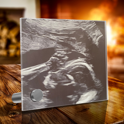 Personalized Baby Sonogram Lumenglass Plaque: Cherish Every Moment