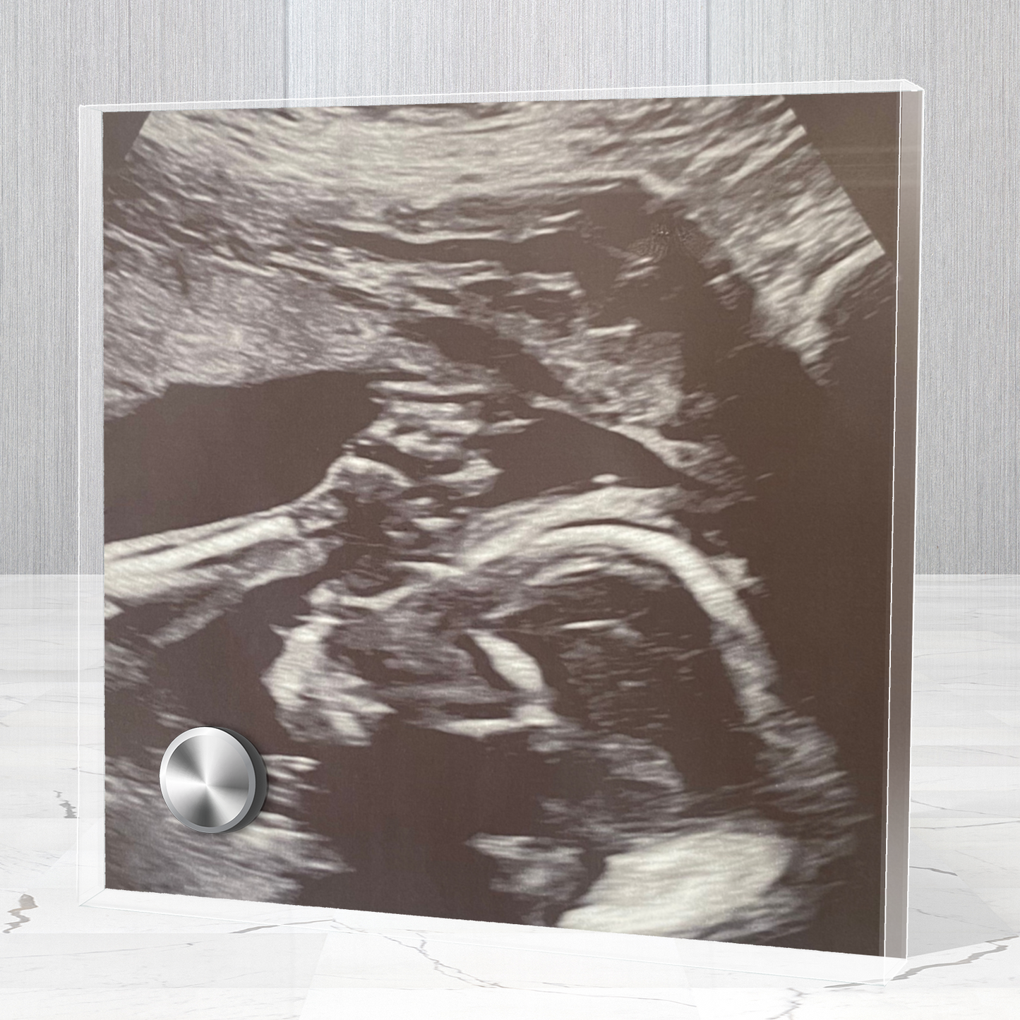 Personalized Baby Sonogram Lumenglass Plaque: Cherish Every Moment