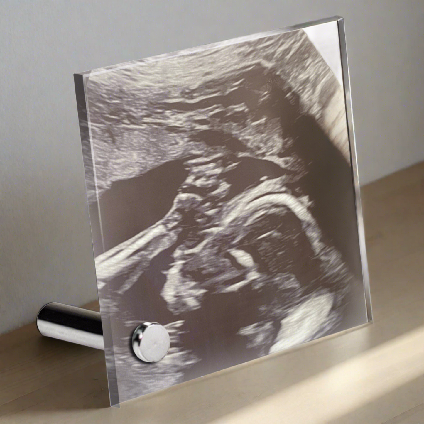 Personalized Baby Sonogram Lumenglass Plaque: Cherish Every Moment