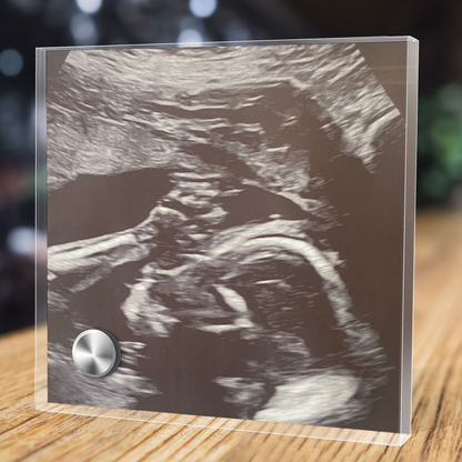 Personalized Baby Sonogram Lumenglass Plaque: Cherish Every Moment